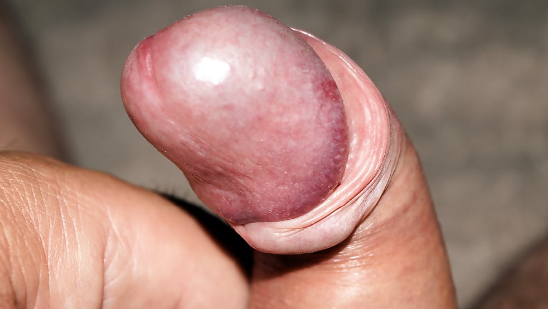 penis ce arată cum arată ce afectează erecția