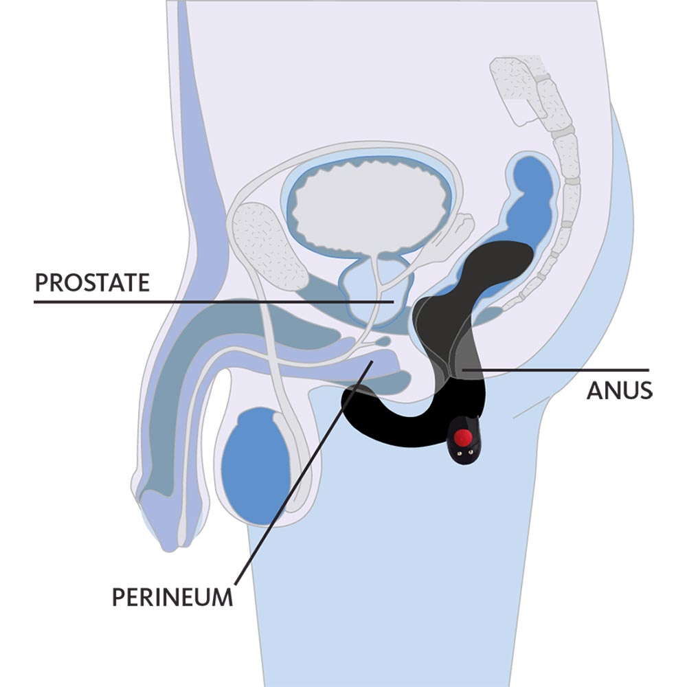 Masator prostata