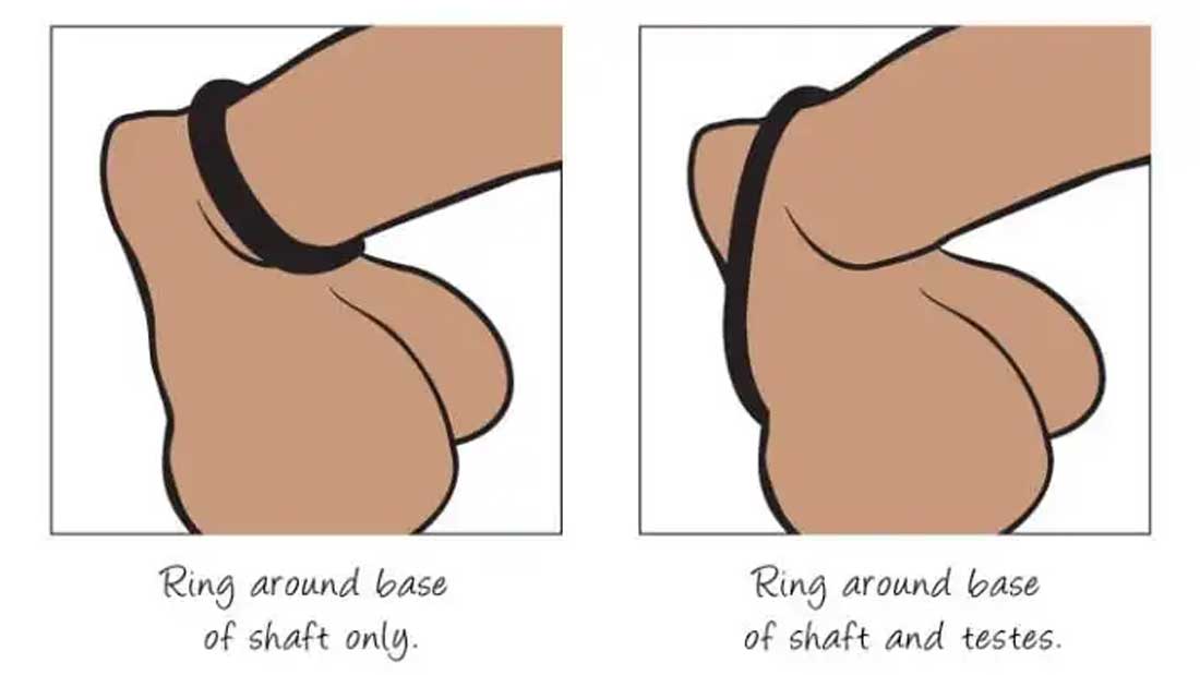 Inel-Pentru-Penis-din-Silicon-Malesation-Cock-Ring3